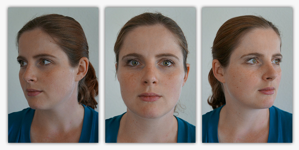 3 Bilder von einem Gesicht im Halbprofil links, von vorne und im Halbprofil rechts