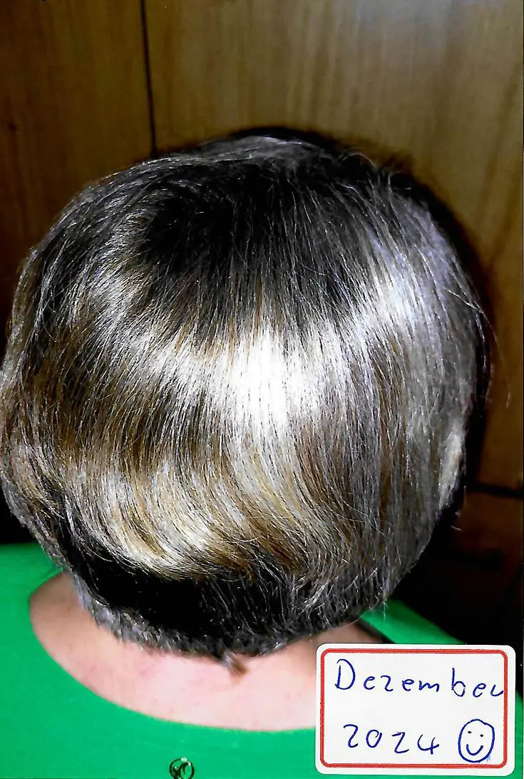 Bild von Haaren einer Frau nach Behandlung durch Michael Münch und Einnahme von MM FitPower - kräftiges, volles Haar