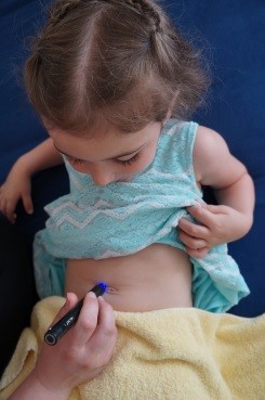 Bild eines Kindes, das mit dem Monolux Pen behandelt wird